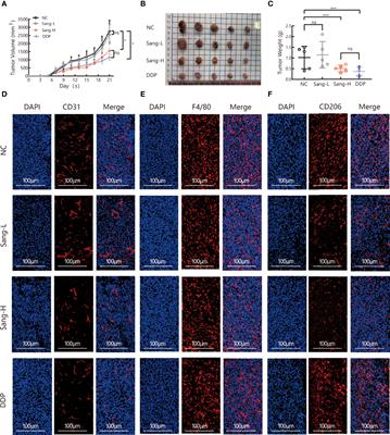 Sanguinarine Regulates Tumor-Associated Macrophages to Prevent Lung Cancer Angiogenesis Through the WNT/β-Catenin Pathway